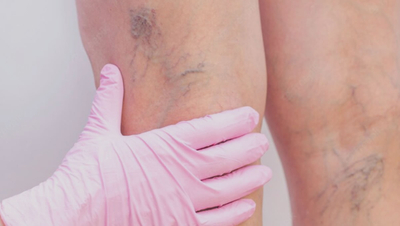 Curso de Alta Performance em PEIM