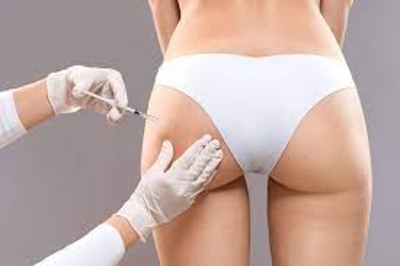 Curso de Preenchimento de Glúteos